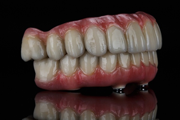 Replacing Upper Or Lower Set Of Teeth With All On