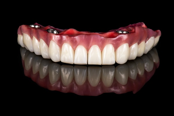 Factors To Consider Before Getting All On Implants