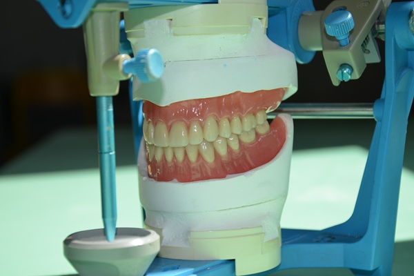 Implant Retained Dentures For Better Chewing Function
